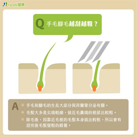 體毛變粗|腳毛會愈刮愈粗？身體 5 處除毛，醫師建議這樣處理